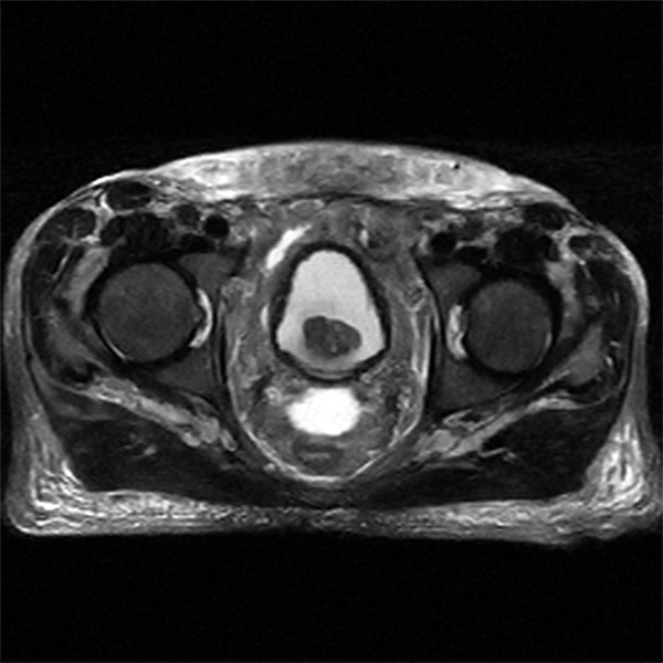 pelvis-1